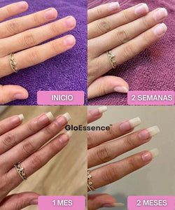 GloEssence Nail - Fortalece y Acelera el Crecimiento de tus Uñas - GloEssence