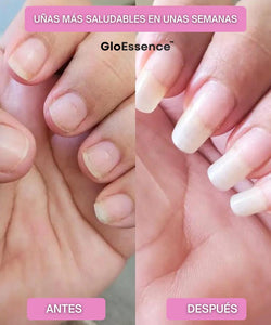 GloEssence Nail - Fortalece y Acelera el Crecimiento de tus Uñas - GloEssence