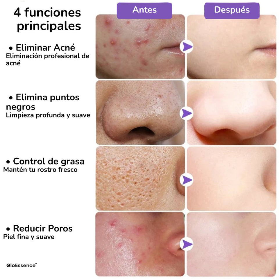 Mascarillas Faciales de Limpieza Profunda - Elige la Ideal para tu Piel - GloEssence